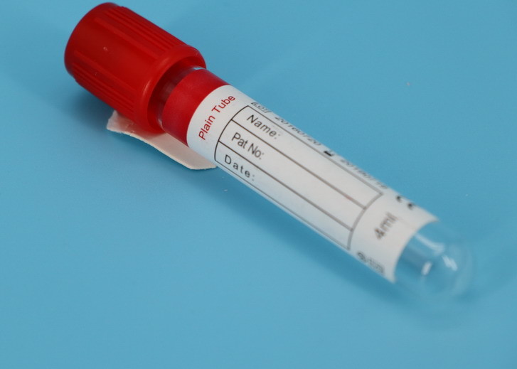 Quality Vacuette Evacuated Blood Sample Centrifuge Tube For Medical Laboratory Use for sale