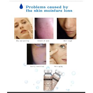 Original Meso Serum Microneedling Stalideram Hyaluronic Acid Serum