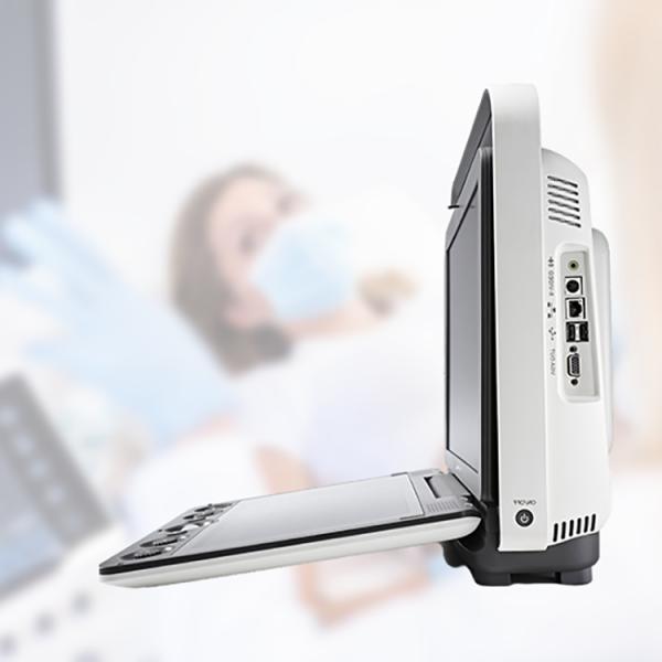Sonoscape S9 Pregnant Baby Medical Diagnosis 4D Color Doppler Sonography Machine Portable Ultrasound