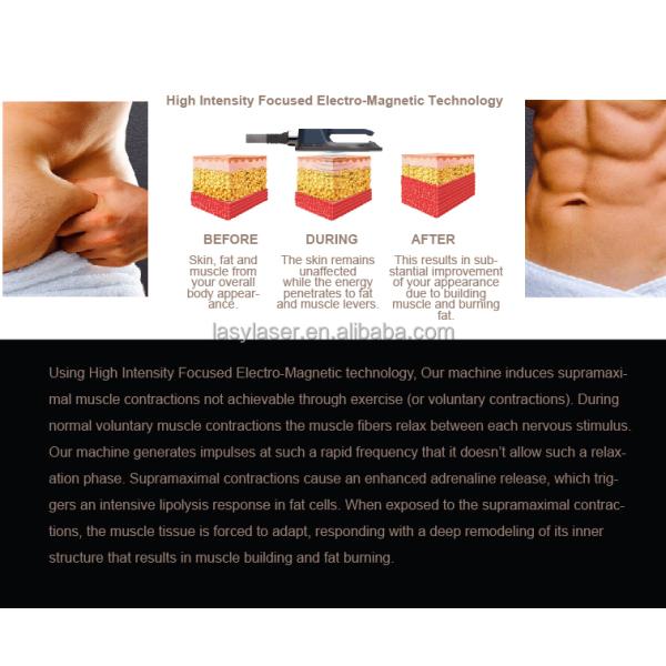 Circslim Aesthetics Body Sculpting Machine , Tesla Hiemt Body Sculpt Machine