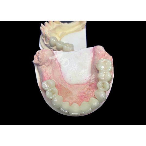 Buy Natural Looking Lava Zirconia Crown With Unrivaled Durability Excellent Biocompatibility at wholesale prices