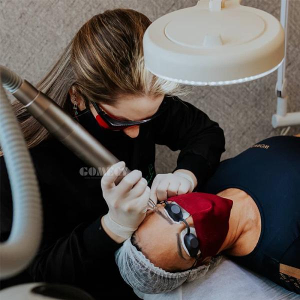 Nd Yag Tattoo Removal Carbon Peel Skin Care Picolaser Machine Q Switched