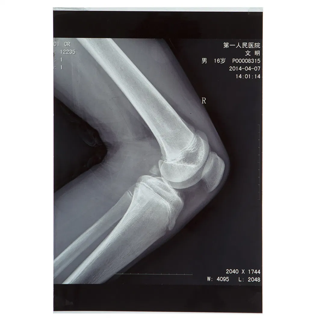 Blue Color 10X12 Inch Inkjet Pet Medical X-ray Film/Image