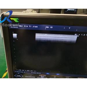 Aloka UST-5413 Linear Ultrasound Probe Scan Image Medical