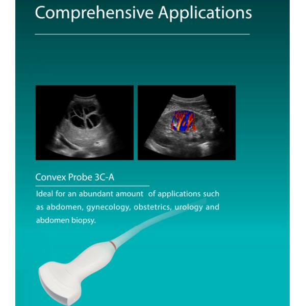 CE approved Sonoscape ultrasound machine Sonoscape X3