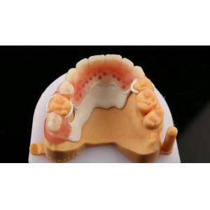 Quality Peek Partial Framework Design ISO CE And FDA Dental Lab Acrylic Partial Denture Framework for sale