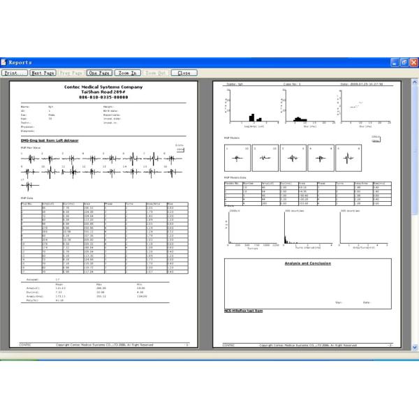 CONTEC CMS6600B Mobile Ultrasound Machine PC Based 4 Channel EMG / EP System