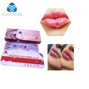 Hyaluronic Acid Dermal Filler With Lidocaine 1ml Lip Augmentation