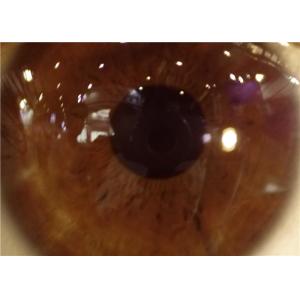 Handheld Slit Lamp Portable Ophthalmoscope Camera