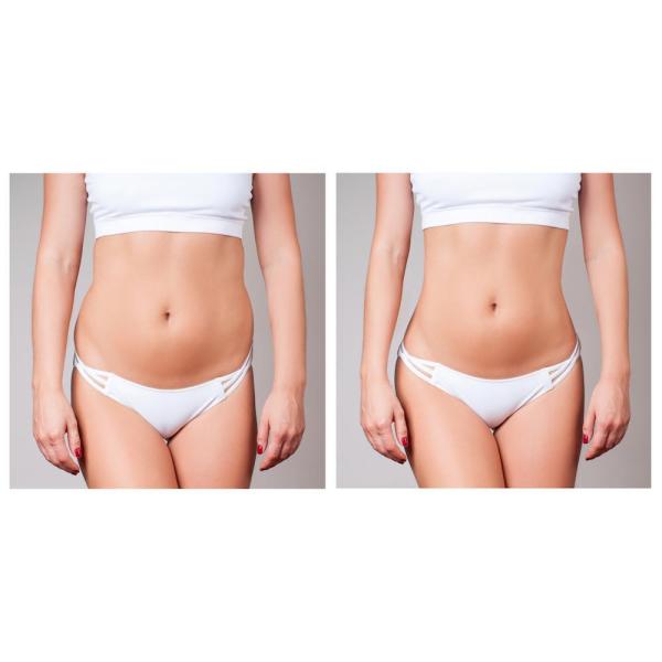 Endosferas 5D Vacuum Roller Infrared Body Shaper Slimming Machine