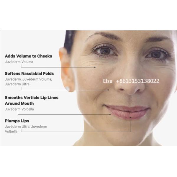 Juvederm Voluma Injectable Dermal Filler 2*1ml 24mg HA Dermal filler