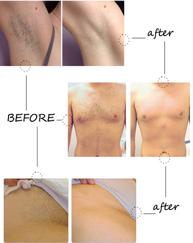 CE approval painless diode hair laser removal machine with Germany imported handles