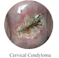 Cervix Camera Video Camera for Vaginal Handheld Digital Mini Colposcope Self -