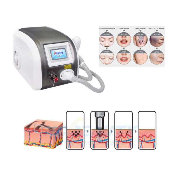 Buy 500w 800w Pico Laser Tattoo Removal Machine Portable at wholesale prices