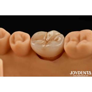 Natural-looking Multilayer Full Zirconia For High Strength And Durability