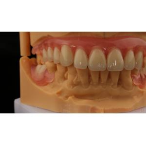 3D Print Model Dental TCS Valplast Flexible Partial Dentures Pink / Dark Color