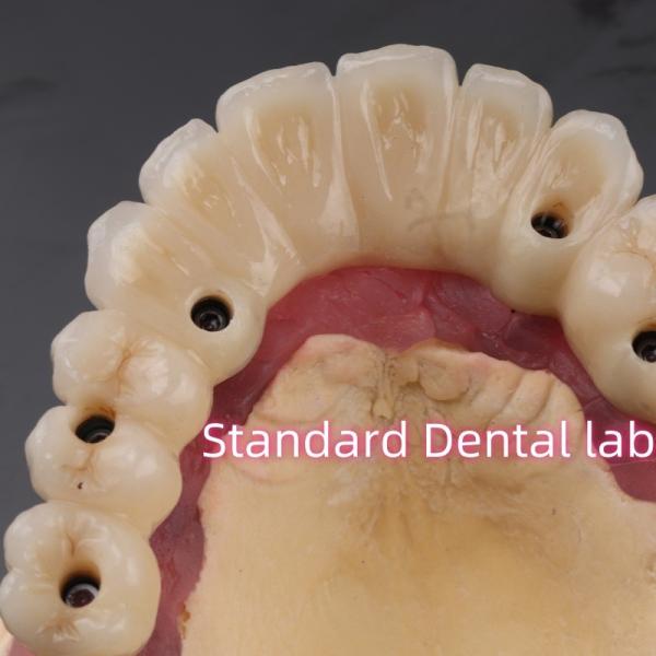 Fast Cement and Save Time Implant Products Dental Zirconia Crowns Bridge