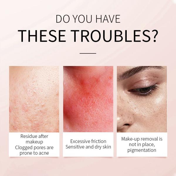 30ml Essence Face Serum 100% Pure Redness Radiant Skin Advanced Rosacea 1