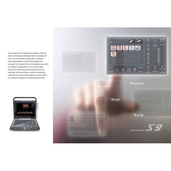 Sonoscape S9 Pregnant Baby Medical Diagnosis 4D Color Doppler Sonography Machine Portable Ultrasound