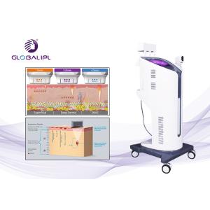 CE Approval HIFU High Intensity Focused Ultrasound Machine 220V / 110V Voltage