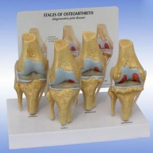 PVC Simulation Medical Skeleton Model Human Pathology Knee Anatomy Model
