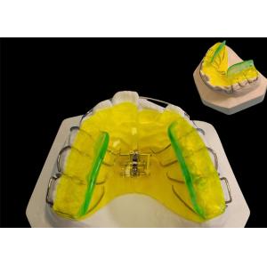 Custom Made Orthodontic Removable Appliances , Adjustable Expander Orthodontics