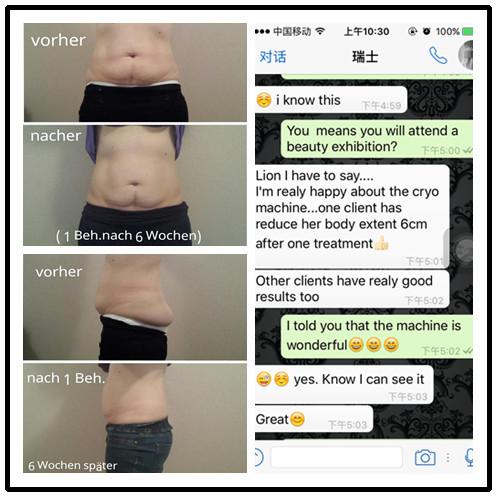 Hot selling high quality CE approval Cryolipolysis Slimming machine