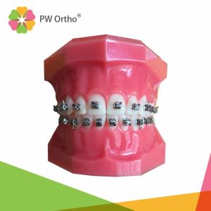 Orthodontic Material Self Ligating Metal Brace Bracket