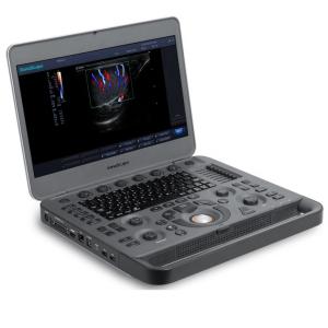 CE approved Sonoscape ultrasound machine Sonoscape X3
