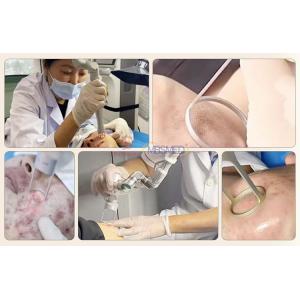 Vaginal Tightening Q Switched Nd Yag Carbon Fractional Co2 Laser Vaginal