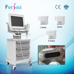 high frequency HIFU face firming radio frequency ultrasound beauty treatment