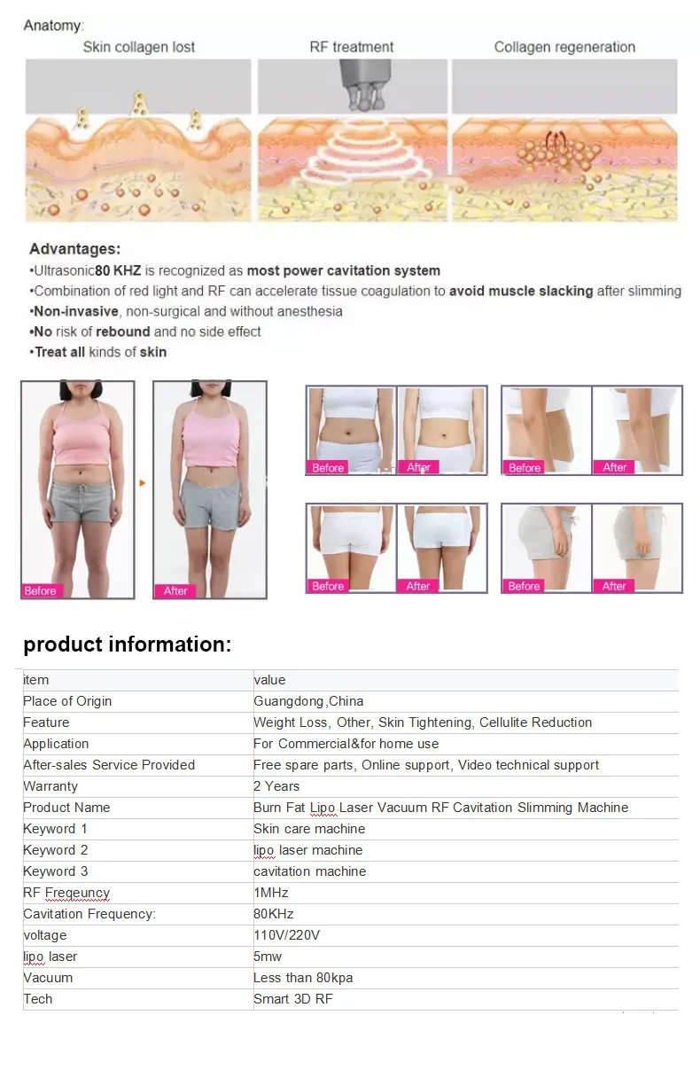 Ultrasound Cavitation Machines RF Cavitation Machine