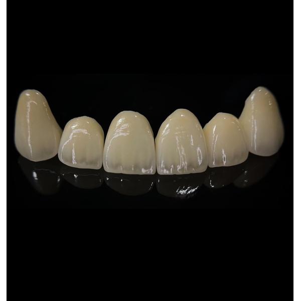 Buy Comfortable Zirconia Crown With Good Fitting And Precision Esthetics at wholesale prices