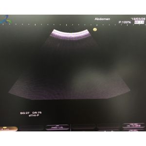Hitachi EUP-C715 Abdominal Ultrasound Probe Imaging Diagnosis