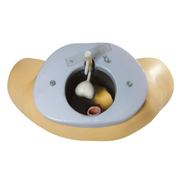 Prostate examination simulator / Clinical simulation with invasive cancer