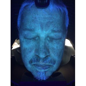 Quality Fcc Analysis Machine Sd Card Save 10 skin Problem Detected for sale