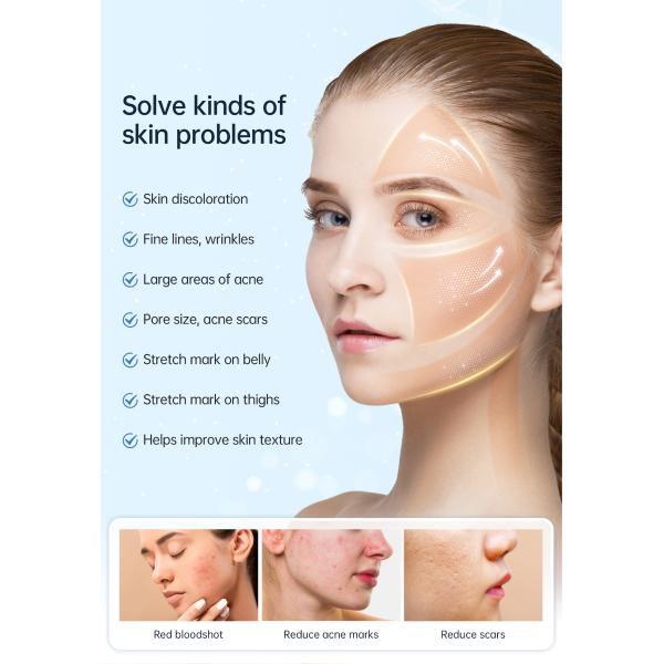 Dermapen 3ml Serum Container Mesotherapy Treatment Microneedle Pen Whitening Treatment 8