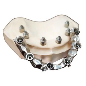 FDA 3014652903 PFM bridge dental Highly Aesthetic Extremely Strong
