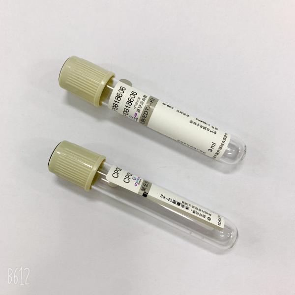 Professional Glucose Blood Tube Sodium Fluoride Grey Top Tube For Glucose