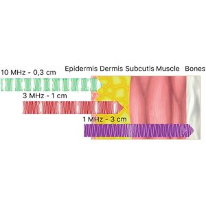 High Frequency Ultrasound Wrinkle Removal Machine Anti Aging LDM Water Drip