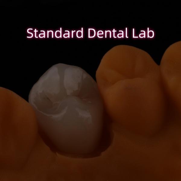 Crown All Porcelain Ceramic Zirconia Ivoclar Esthetic Teeth OEM