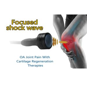 Physical Therapy Physiotherapy Pain Treatment Eswt Shock Wave Dual Handles