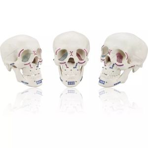 Orthopedic Surgical Mini Maxillofacial Plate Instrument Set