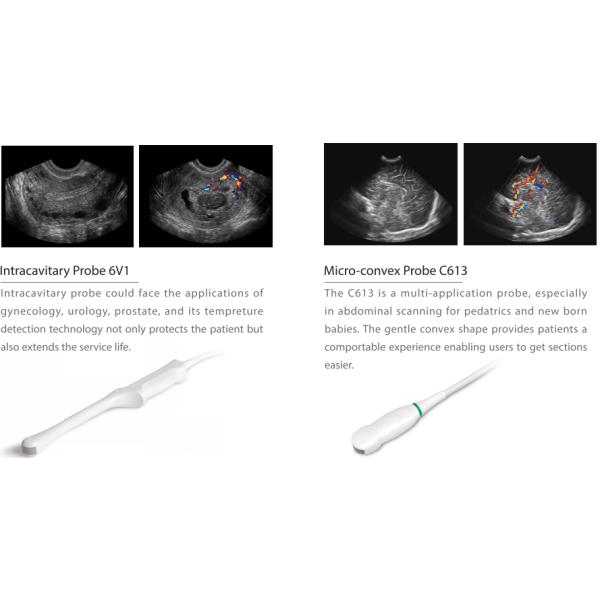 CE approved Sonoscape ultrasound machine Sonoscape X3