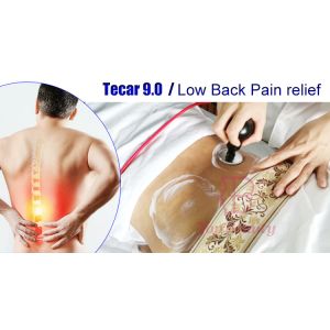 448khz Indiba Ret Cet RF Tecar Physical Therapy Machine Pain Relief Body