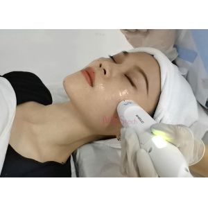 High Intensity Focused Ultrasound 9D HIFU Machine Wrinkle Removal
