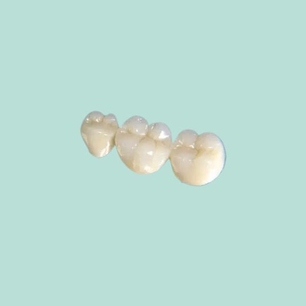 Oral Hygiene Dental Crown Bridge Change Tooth Color Good Stability