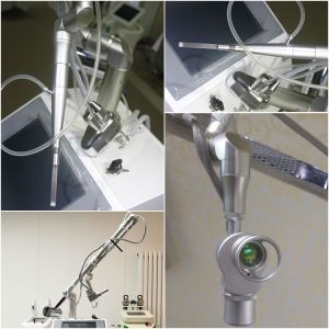 fractional co2 laser,three system,normal,fractional,gynecology