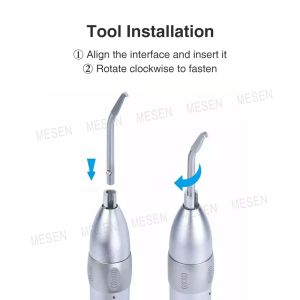 Dental Crown Remover