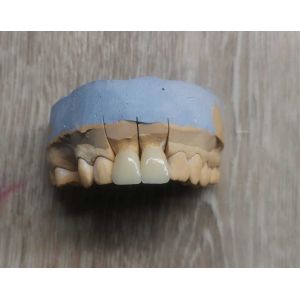 YUCERA ST Color Yucera Dental Laboratory Zirconia Blank Cad Cam A1/a2/a3 Color